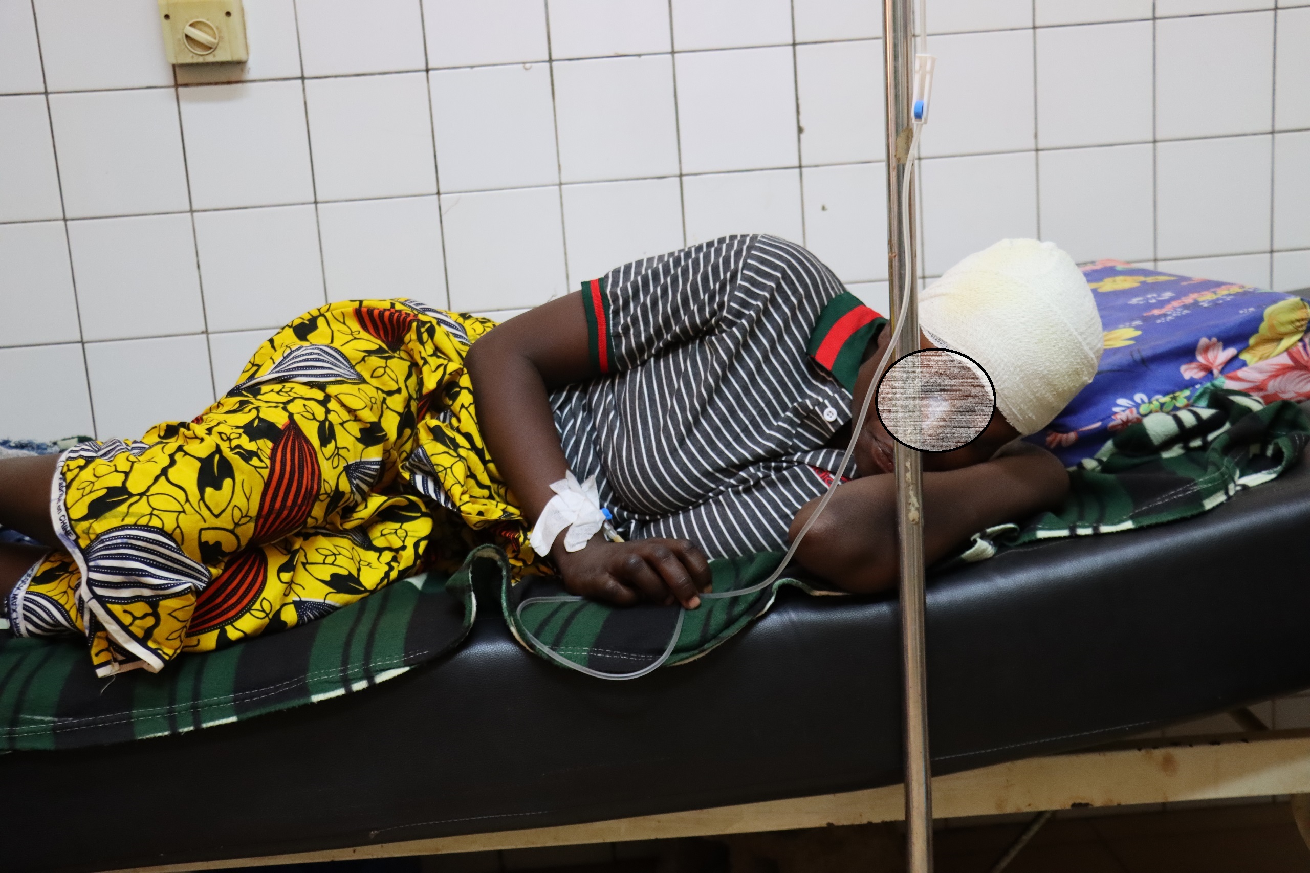 La rescapée à la pioche, retour sur un miracle médical à Ouahigouya