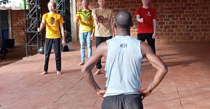 Bobo Dioulasso : l’art, réponse aux préjugés sur l’albinisme