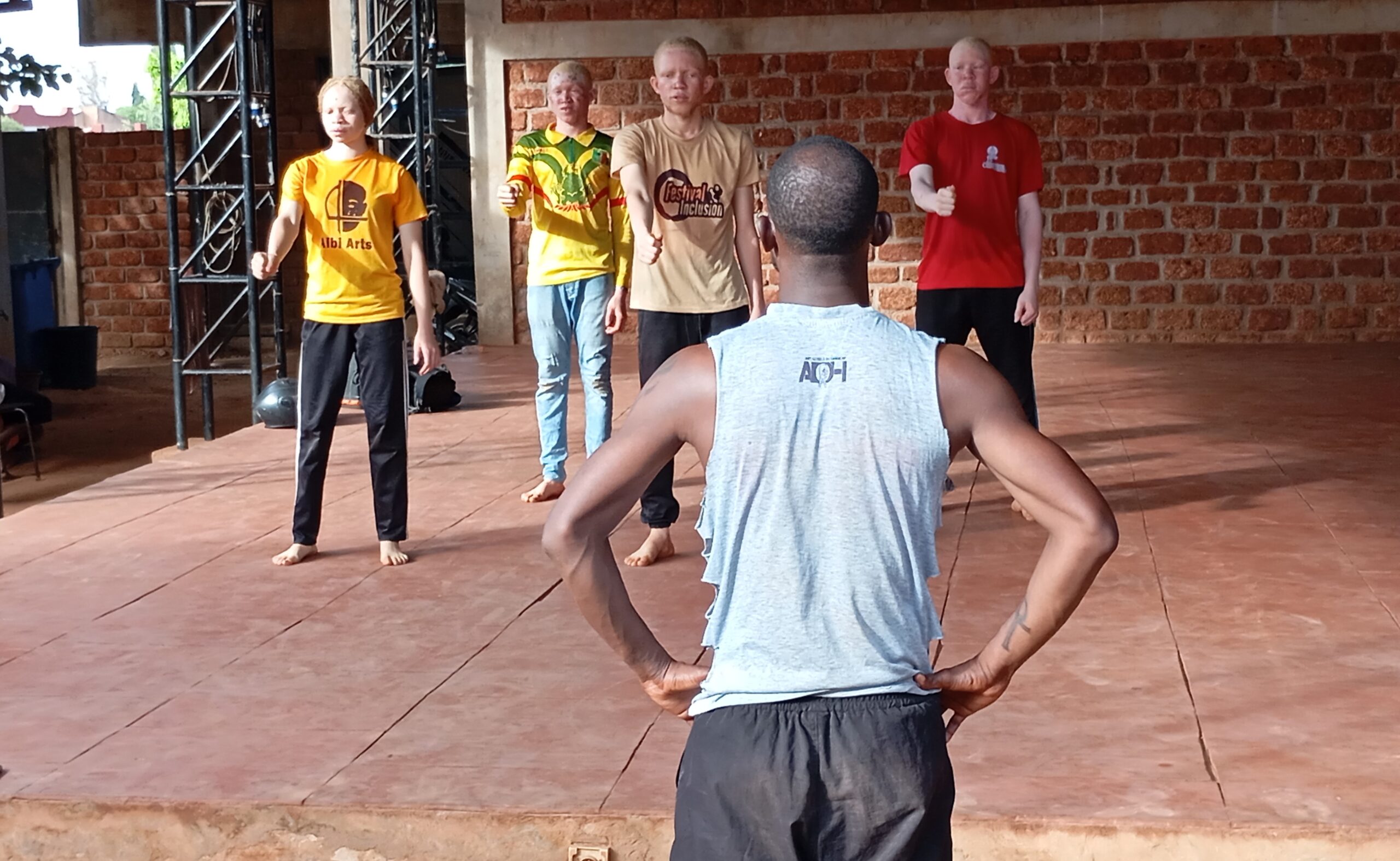 Bobo Dioulasso : l’art, réponse aux préjugés sur l’albinisme 