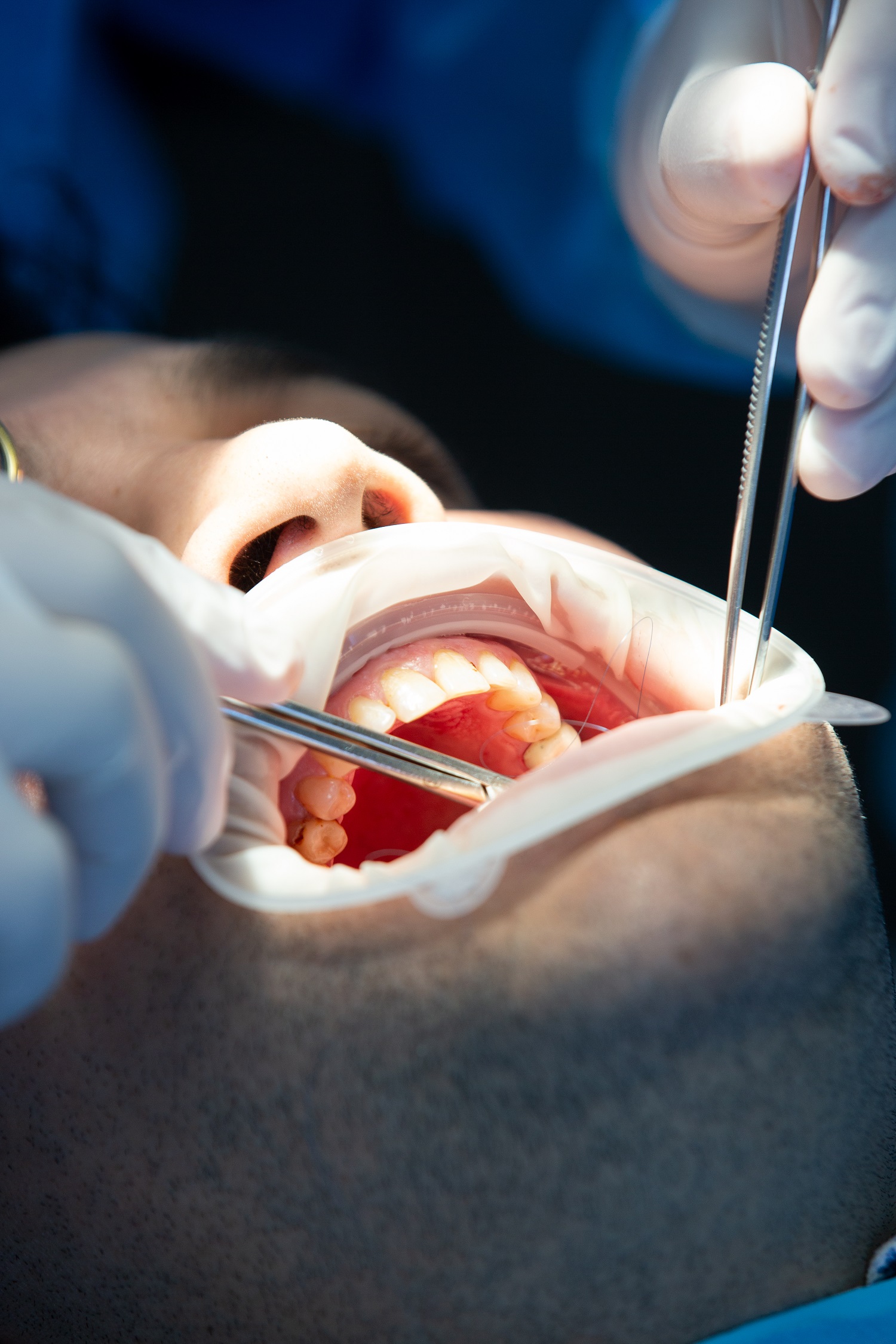Maladies bucco-dentaires : les bons réflexes pour protéger ses dents et éviter les complications